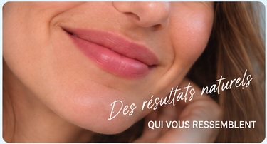 Lèvres